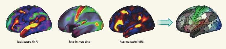نقشه مغز