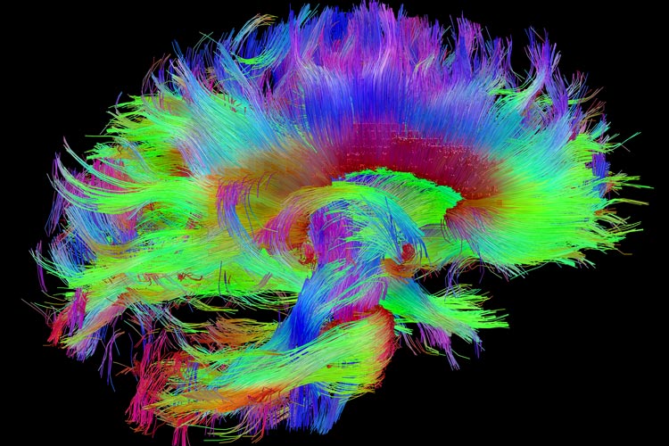 کشف احتمالی منبع فیزیکی خودآگاهی در مغز