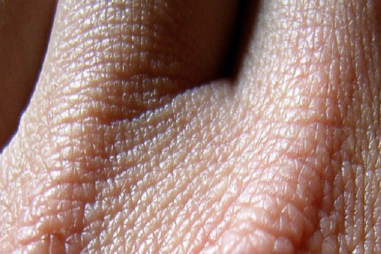 چرا پوست ما همیشه در برابر نفوذ مایعات مقاوم است؟