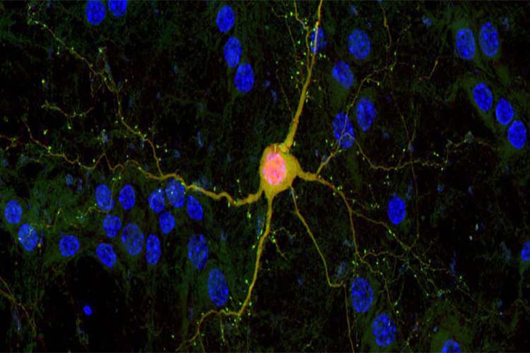 روش تازه‌ی دانشمندان برای تزریق سلول‌های عصبی سالم به مغزهای آسیب دیده
