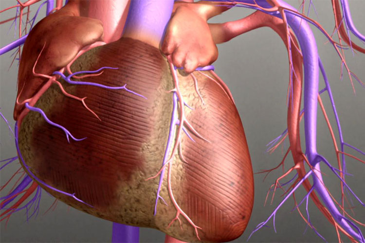 ساخت قلب مصنوعی به کمک تکنولوژی پرینت سه‌ بعدی
