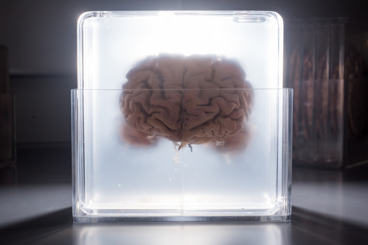 مغز انسان در محلول 