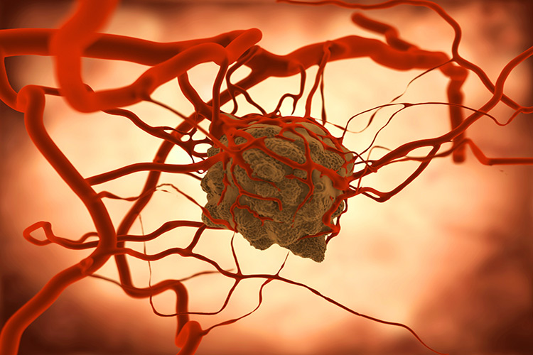 ارتباط رگ های خونی و سیستم ایمنی در روند درمان سرطان 