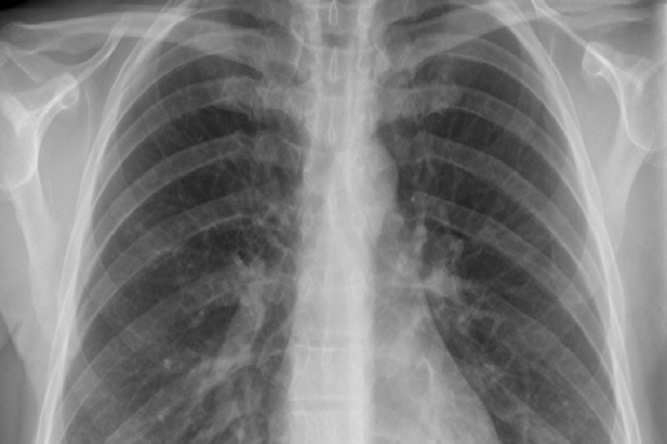 سامانه الکترونیکی تشخیص بیماری از طریق صدای تنفس بیمار