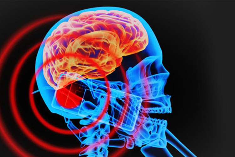 محققان استرالیایی می‌گویند گوشی موبایل با تومور مغزی ارتباط ندارد