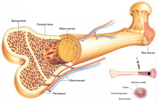 marrow transplant