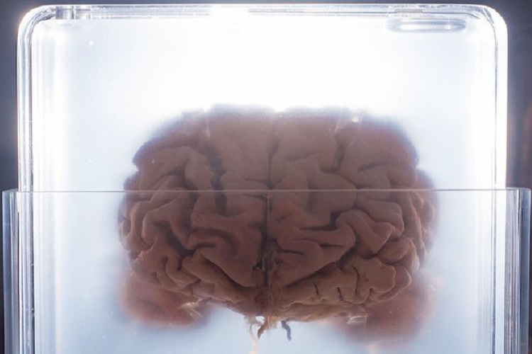 چرا انسان‌ها مغز بزرگ و پیچیده‌ای دارند