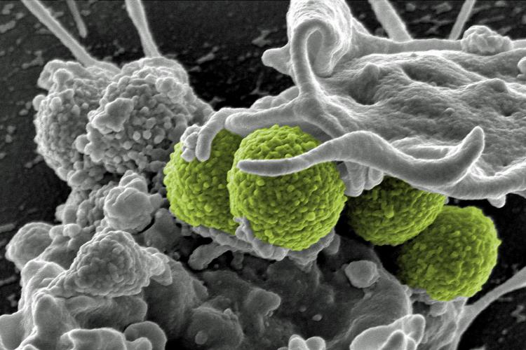 باکتری سالمونلا از میدان الکتریکی تبعیت می‌کند