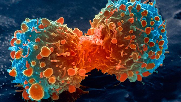یک سلول سرطانی ریه در حال تقسیم 