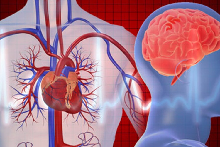 آشنایی با بیماری های حمله قلبی و سکته مغزی