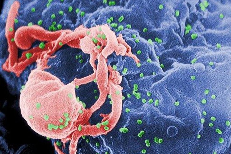 روشی جدید برای یافتن محل اختفای ویروس HIV در بدن