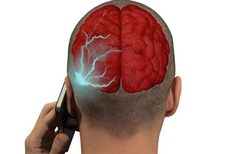 نتایج یک پژوهش پیرامون اثرات امواج موبایل بر مغز در تلفن‌ های همراه اولیه