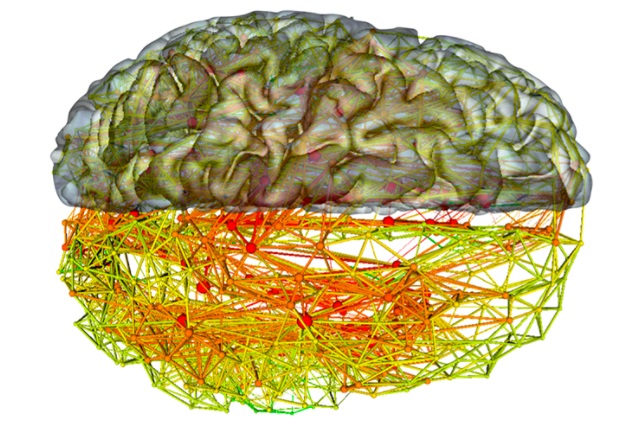 شبکه های عصبی و مغز