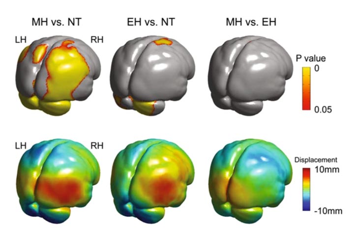 مقایسه شکل مغز بین نئاندرتال‌ها، هومو ساپینس‌های اولیه و هومو ساپینس‌های مدرن
