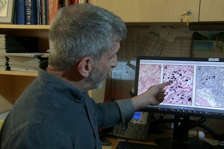 شناسایی یک عضو جدید در بدن انسان