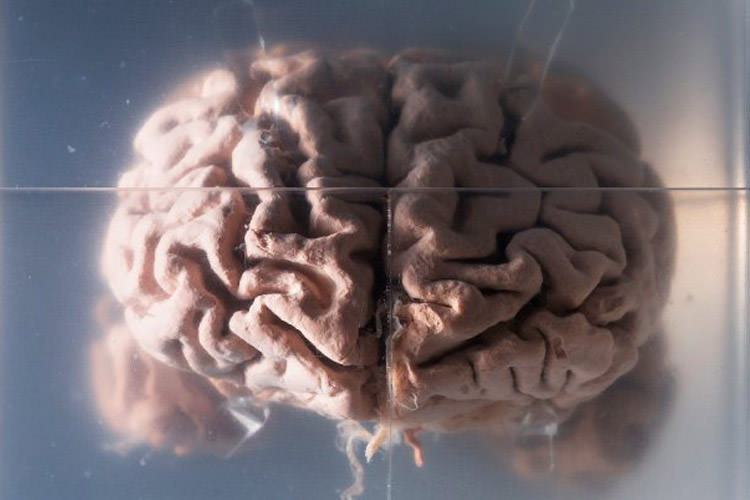 پاسخ به یک سؤال قدیمی: چرا مغز انسان تا این اندازه بزرگ است؟