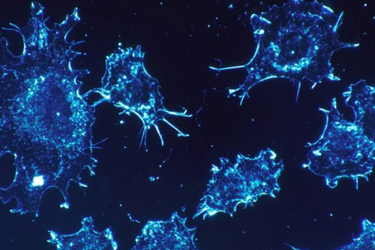 درمان‌های جدید سرطان، پیری و عفونت‌های ویروسی با اتکا به کشف جدید