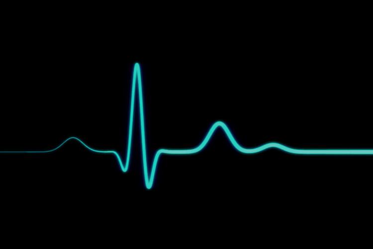 نوار قلب / EKG / ECG