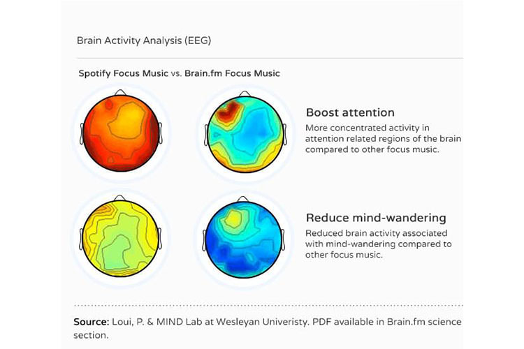 اپلیکشین موسیقی مغز