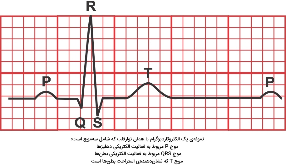 نوار قلب / الکتروکاردیوگرام / ECG / EKG