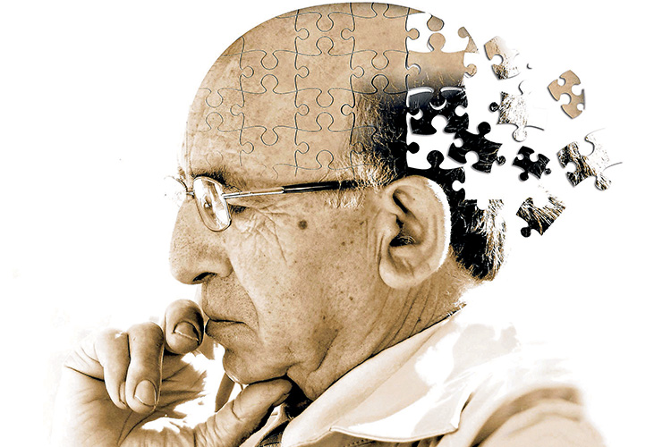 آلزایمر 🧠 علائم ، راه های درمان ، تشخیص و دلایل این بیماری را بشناسید -  زومیت