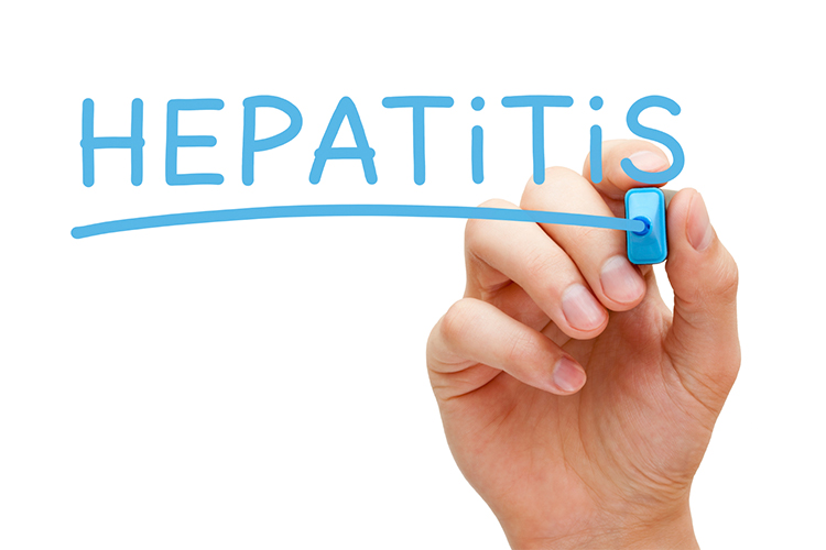بیماری هپاتیت: علت‌ها، علایم، درمان و پیشگیری