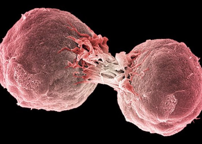 سلول سرطانی در حال تقسیم