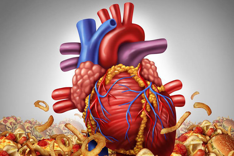 قلب سالم در بدن سالم؛ دوازده خوراکی که باعث مشکلات قلبی می‌شوند