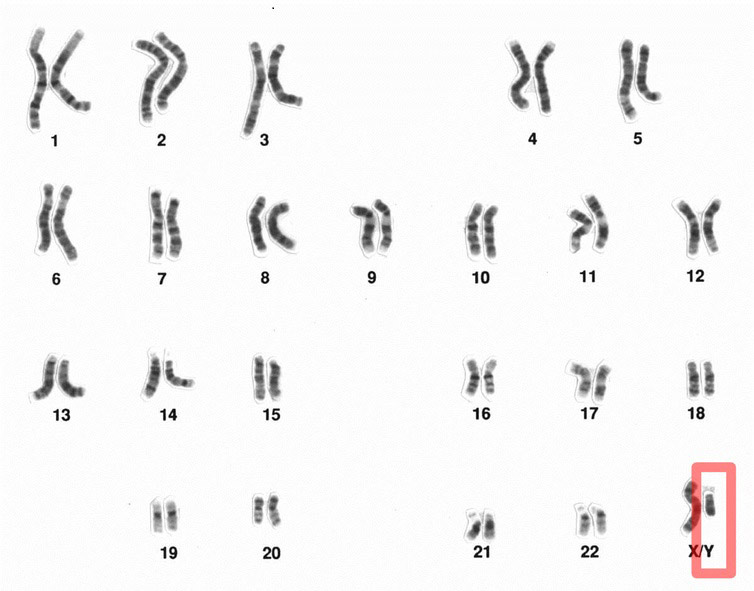 کروموزم / chromosome