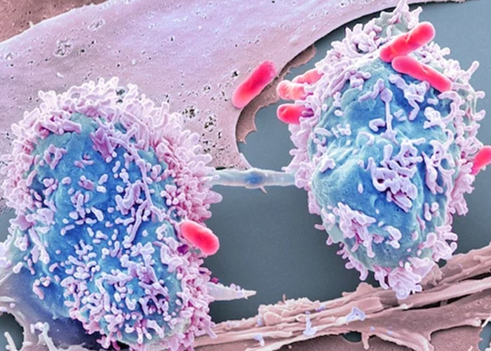 تقسیم سلول سرطانی