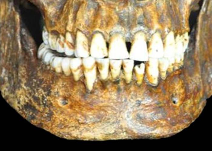 دندان باستانی