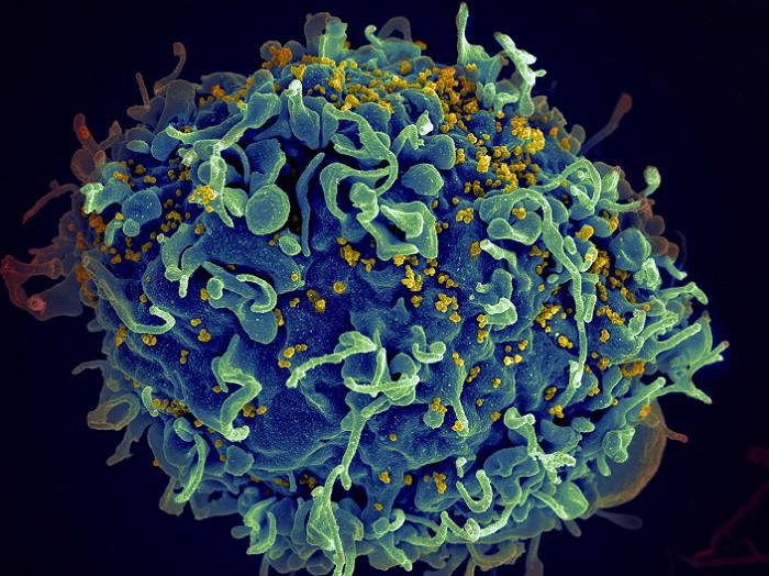 سلول آلوده با ویروس HIV
