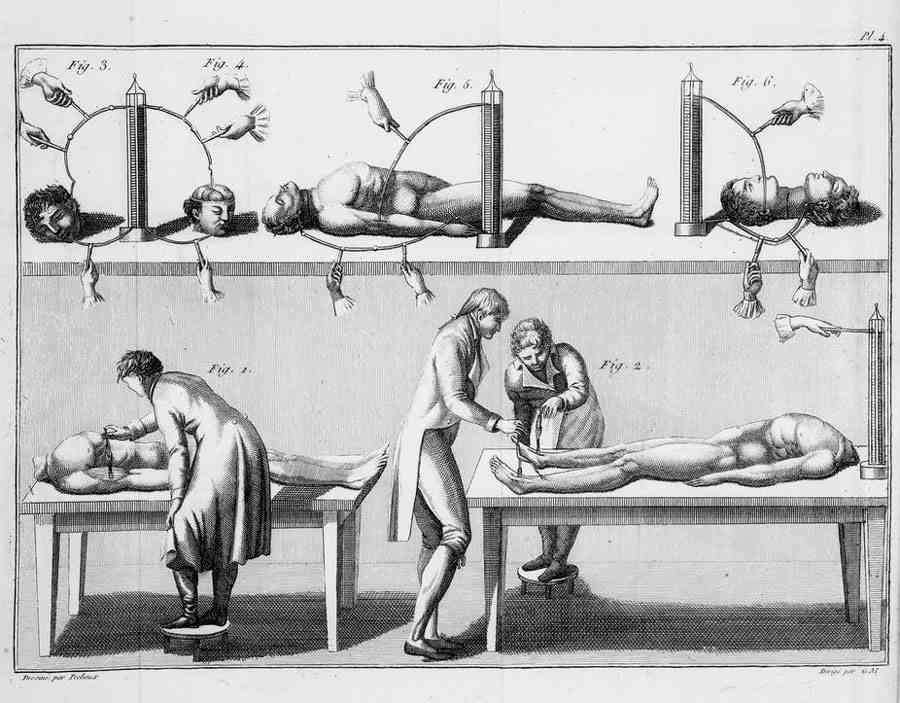 جیووانی آلدینی در حین انجام یکی از آزمایش‌های مشهورش