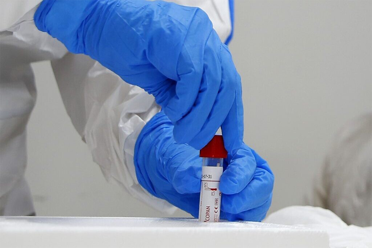 افزایش حساسیت آزمایش‌های کرونا در کشور با استفاده از کیت‌های سرولوژی