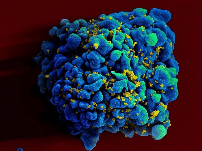 سلول انسانی آلوده به ویروس HIV