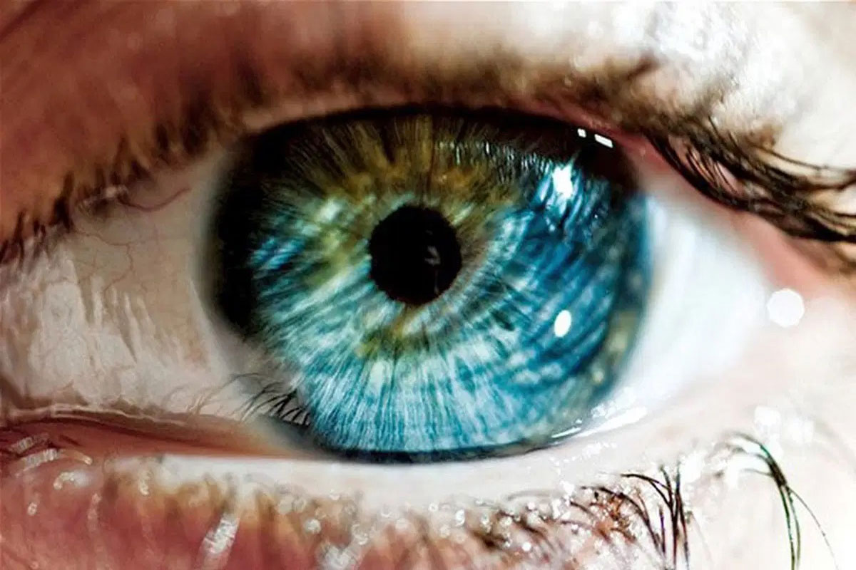 پزشکان استرالیایی اولین چشم بیونیکی جهان را آزمایش کردند