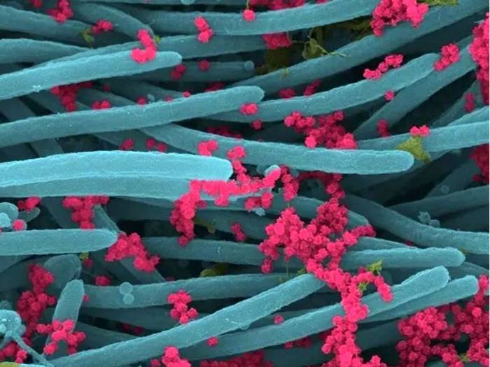 ویروس کرونا در سلول های پوششی تنفسی 