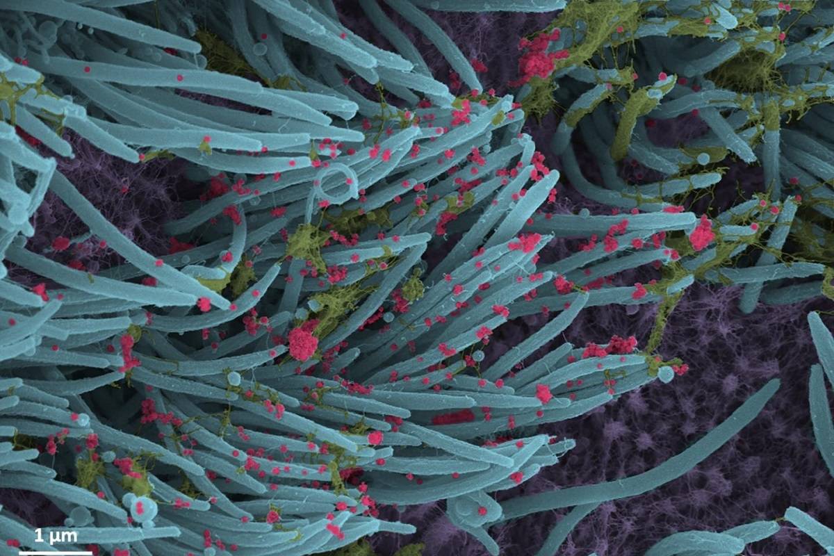 تصاویری جالب از چگونگی آلوده‌سازی سلول‌های ریه توسط ویروس کرونا