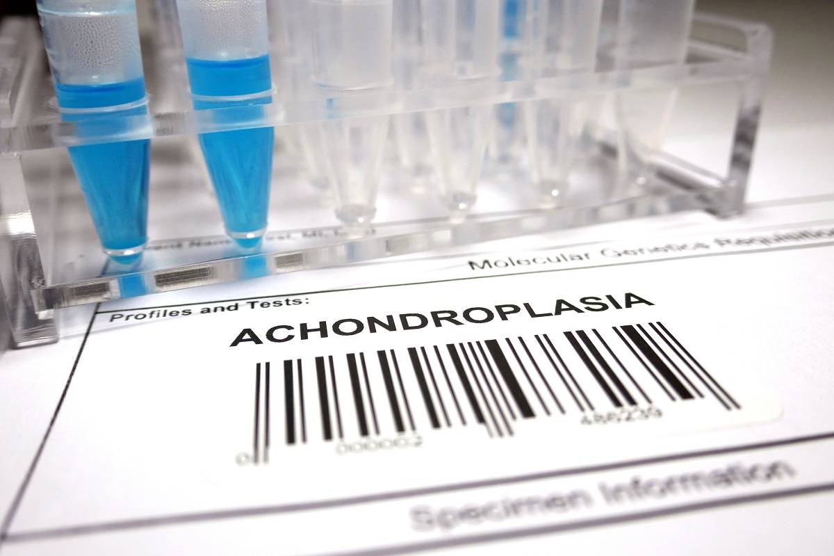 FDA اولین دارو را برای علت ژنتیکی کوتاه‌قامتی تأیید کرد