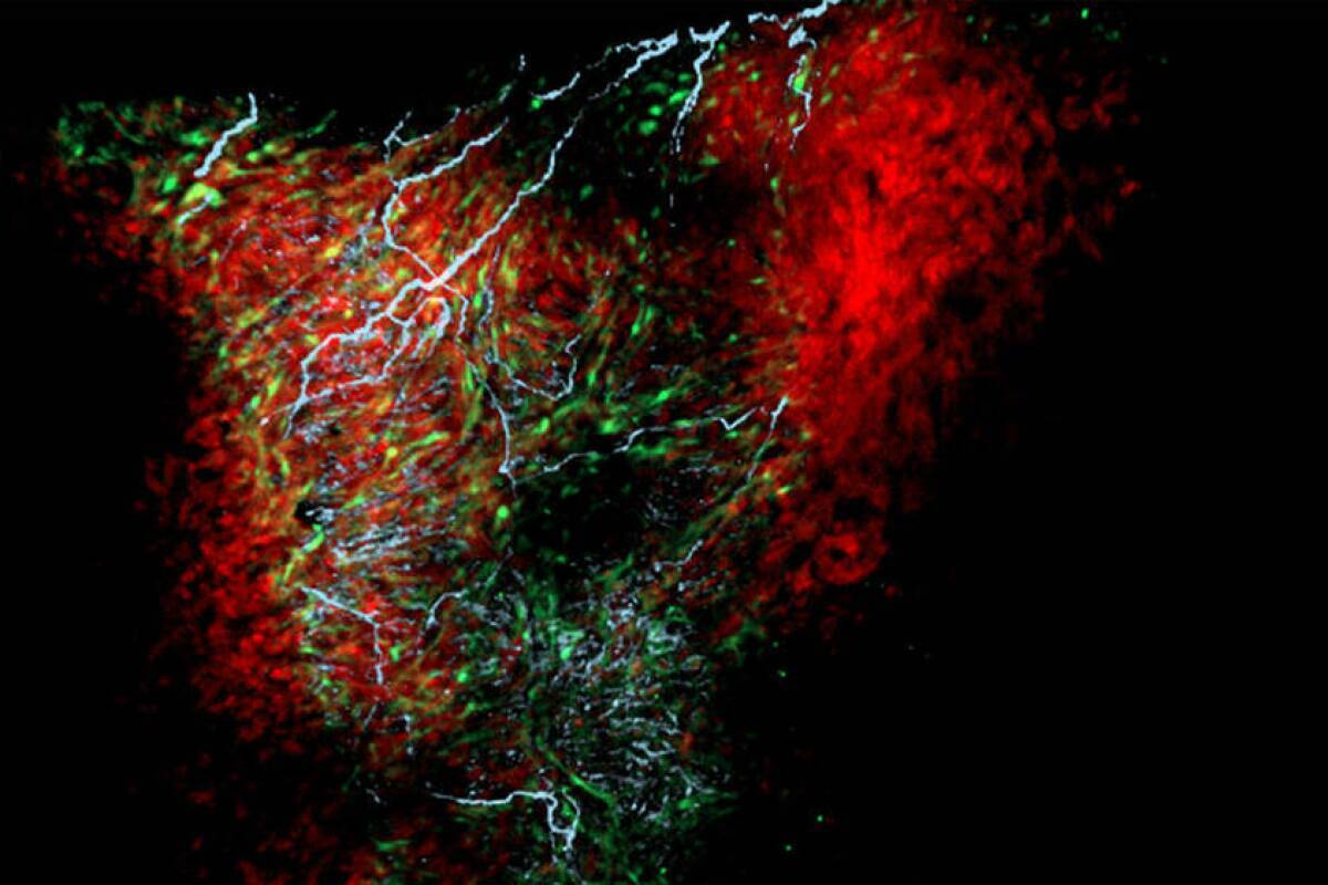 کشف نوع جدید سلول‌ در قلب که با تنظیم ضربان قلب ارتباط دارد