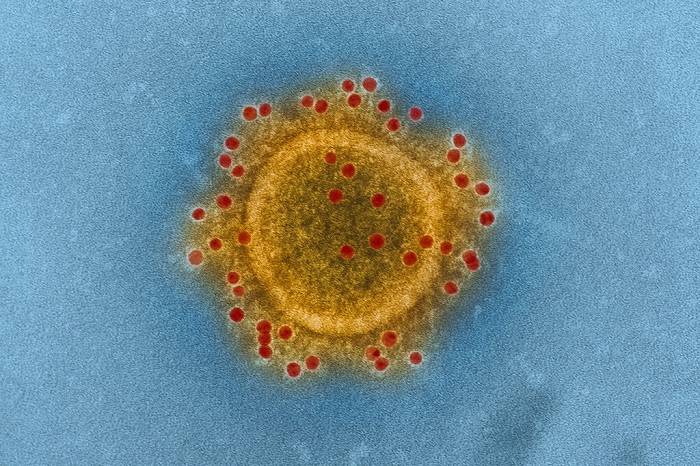 ویروس مرس / MERS virus