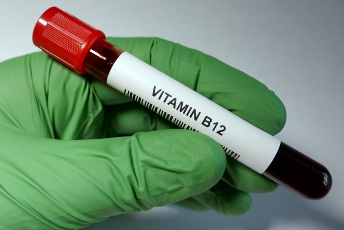 آزمایش خون برای تعیین کمبود ویتامین A