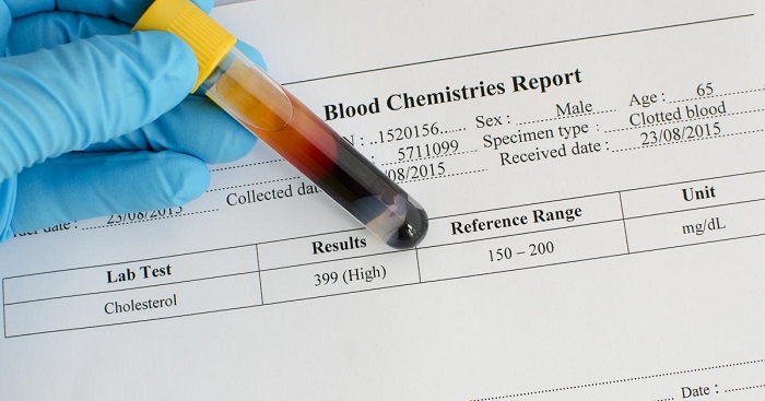 آزمایش خون برای اندازه گیری کلسترول خون