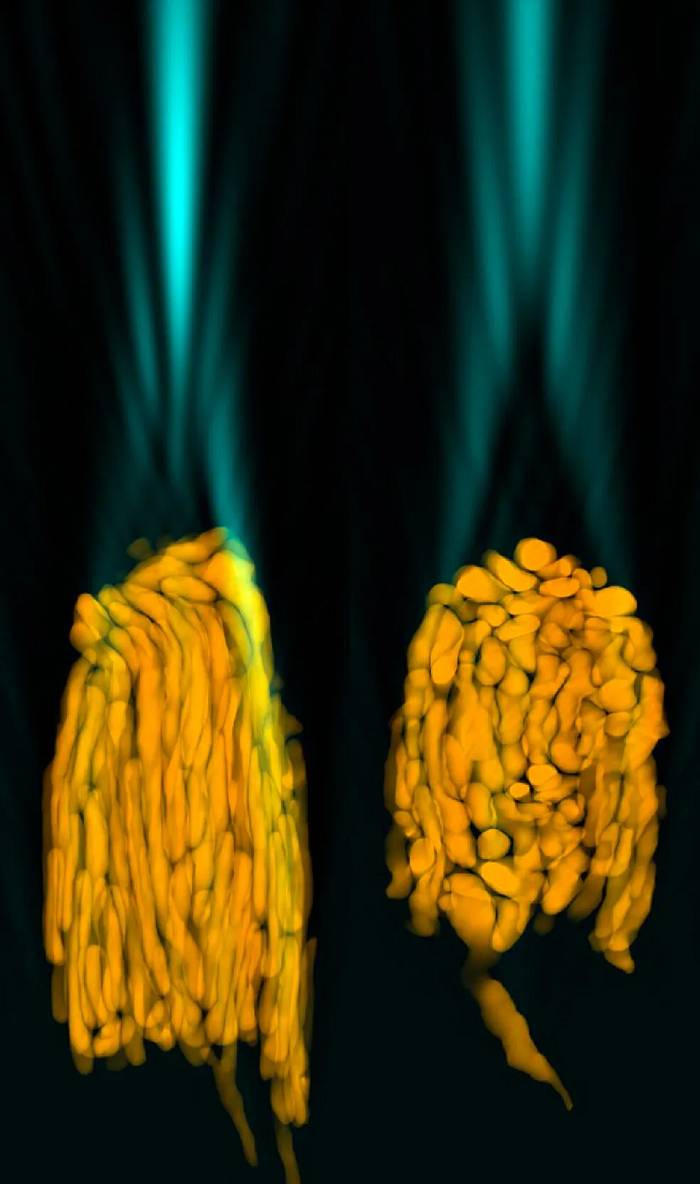 میتوکندری ها در چشم سنجاب زمینی / mitochondrial bundles 