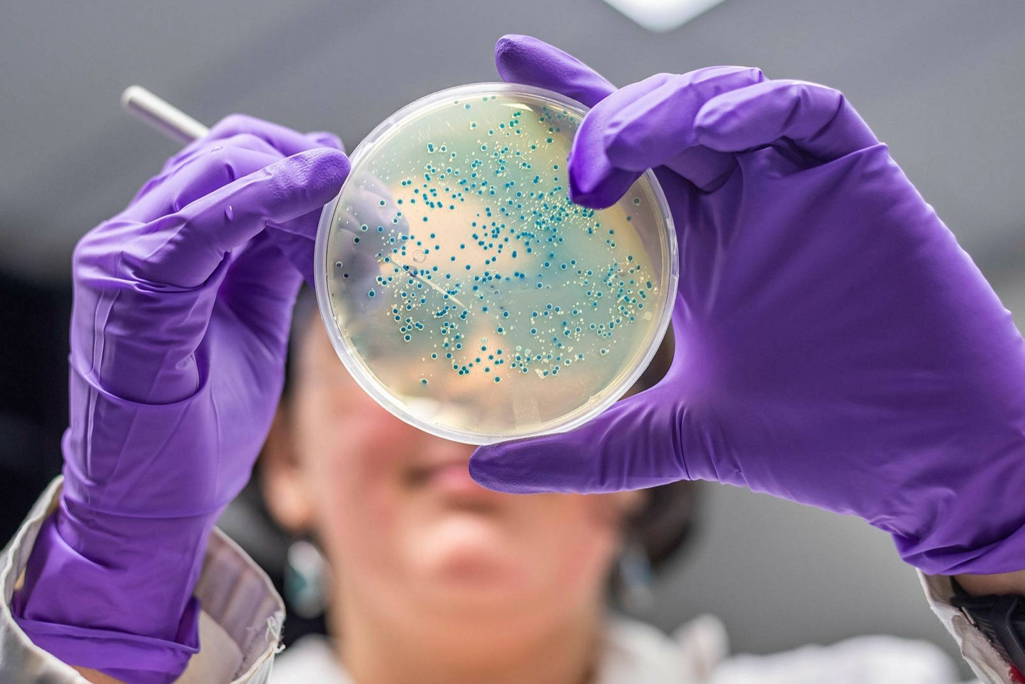 موفقیت ویروس‌های باکتری‌خوار در درمان عفونت‌های مقاوم به آنتی‌بیوتیک