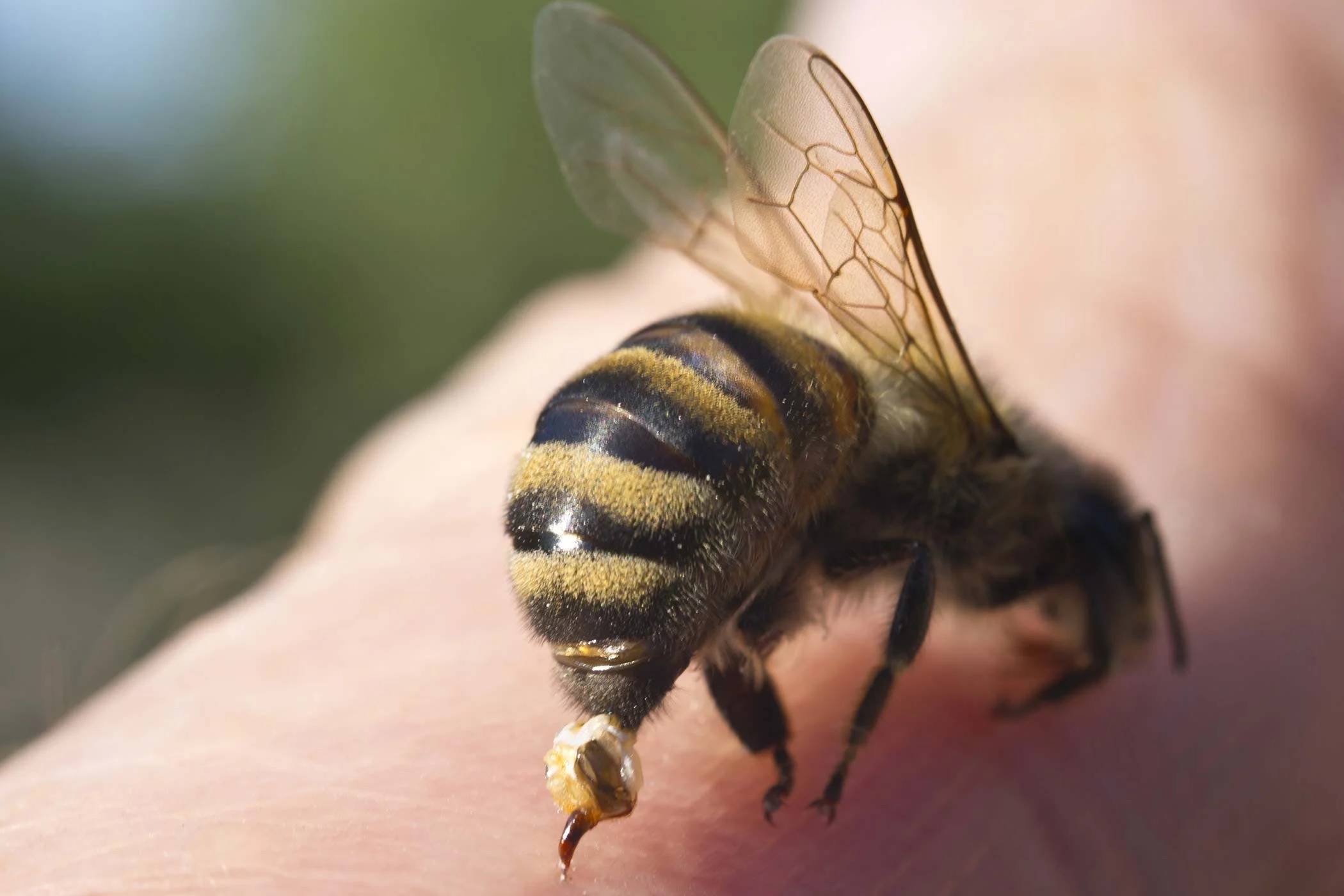 اگر زنبور ما را نیش بزند، واقعاً می‌میرد؟