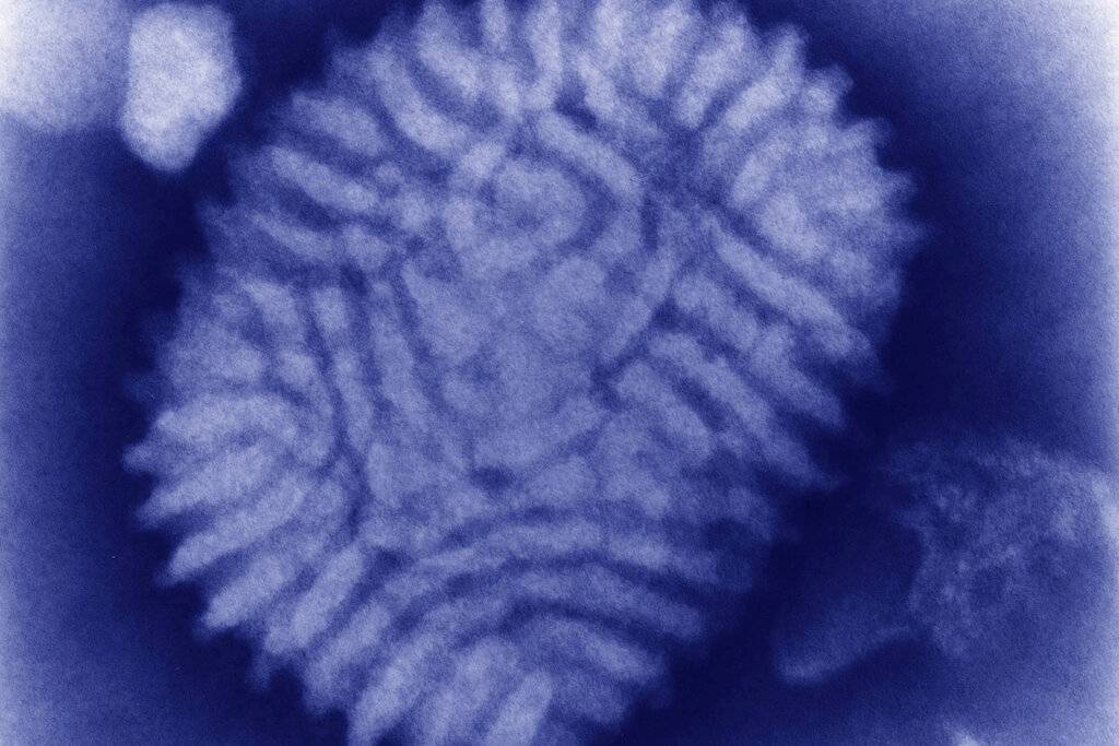 ویروس میکسوما / myxoma virus