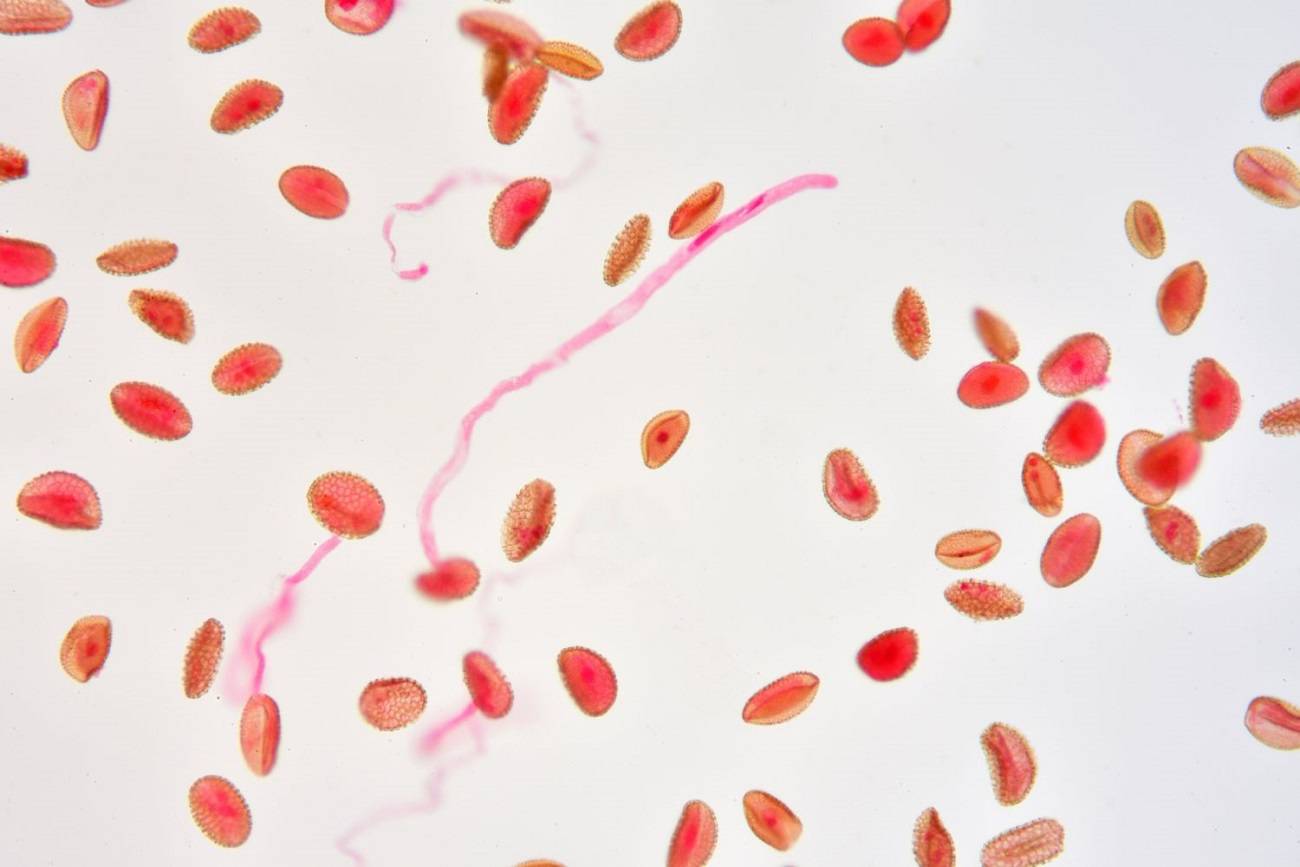 دانه گرده گیاه / pollen