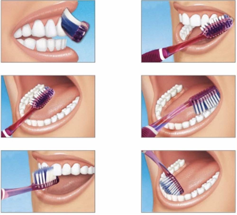 روش مسواک زدن بس / Bass tooth brushing technique 