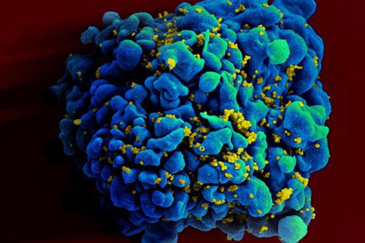 یک قدم تا نابودی کامل ایدز: محققین موفق به پاکسازی کامل ویروس HIV از سلولها شدند